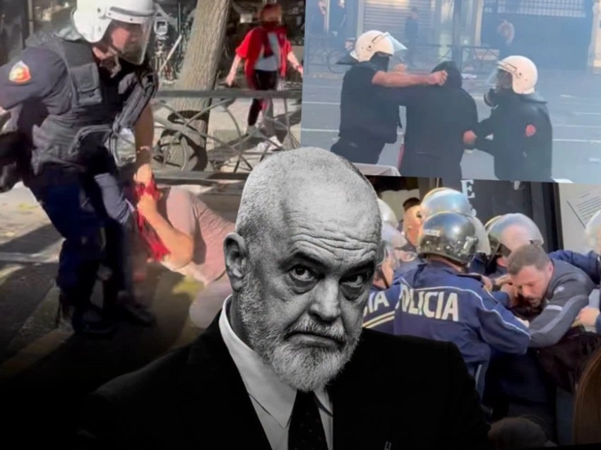 Kriza politike në Tiranë, publicisti Adriatik Riza Dosti lëshon akuza të forta ndaj kryeministrit Rama