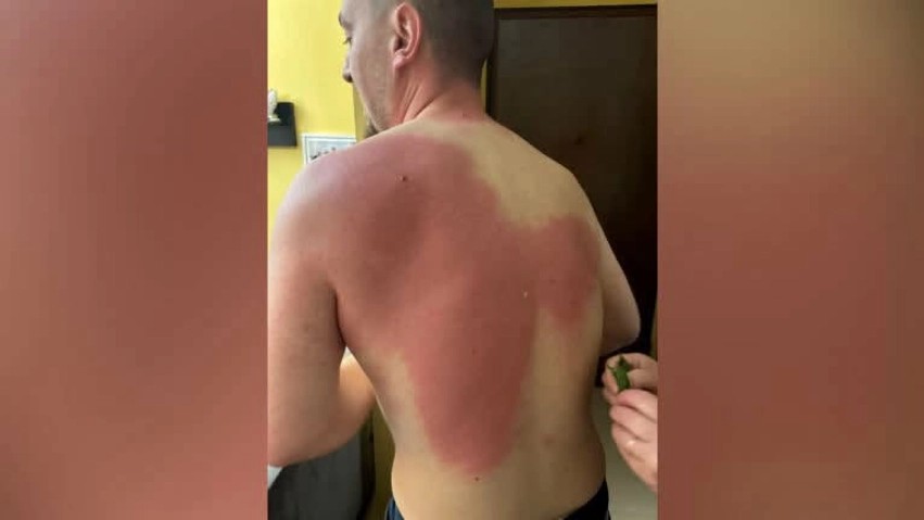 Sulmi ndaj gazetarit në protestë, Berisha: Akt kriminal dhe atentat ndaj lirisë së fjalës