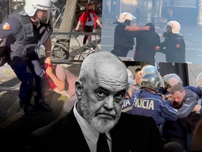 “Studentët po sakatohen për karrigen e Ramës” – Dosti lëshon zjarr: Banda e tij i ka ditët e numëruara
