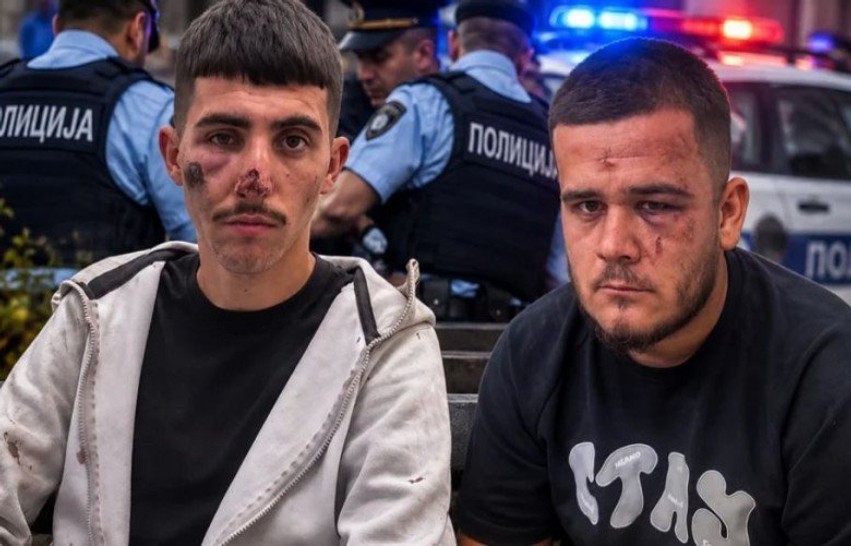 Incidenti në Shkup: Dy të rinj shqiptarë akuzojnë policinë për dhunë brutale gjatë legjitimimit