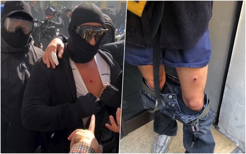 Tensionohet situata para Ministrisë së Arsimit: Policia përdor për herë të parë plumbat e gomës ndaj protestuesve