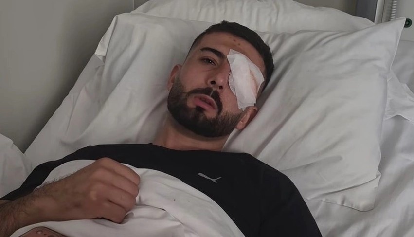“Më goditën papritur, ende e kam plumbin në sy” – Flet tifozi i plagosur gjatë protestës së studentëve