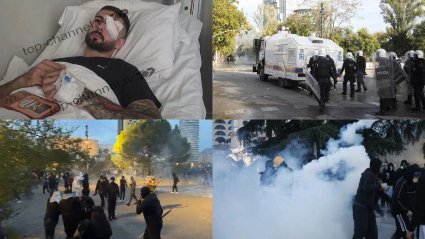 Hetim ndaj Policisë së Shtetit: Prokuroria zbardh dhunën në protestë, Erjon Vishkulli po kurohet në Itali